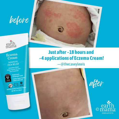 Earth Mama Eczema Cream